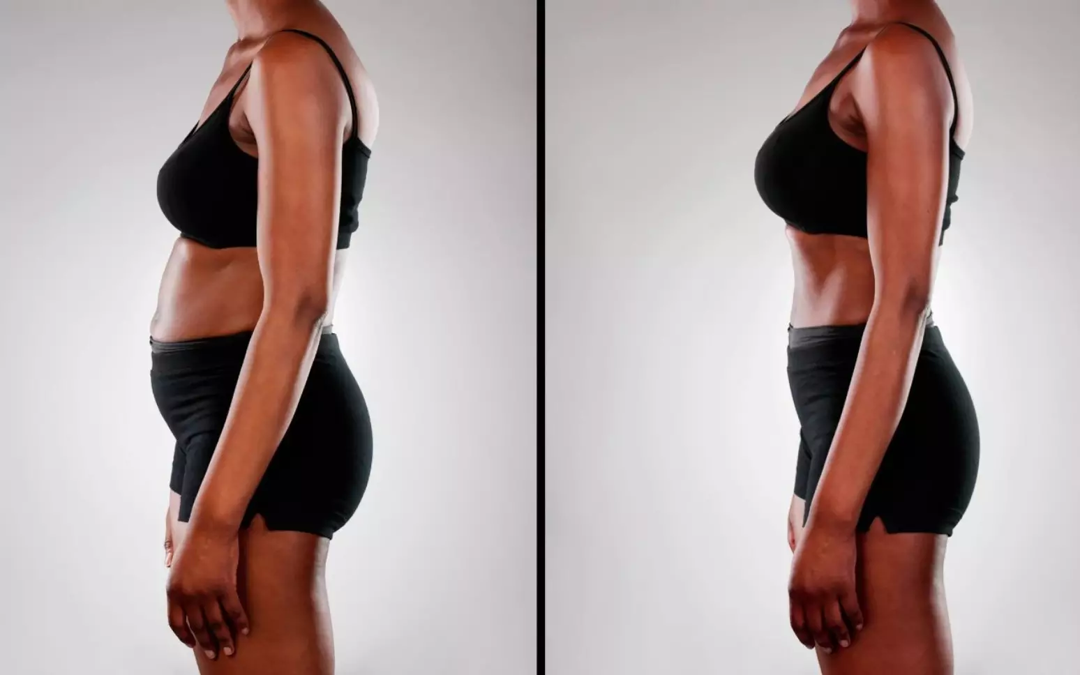 Antes e depois de Marcela R.