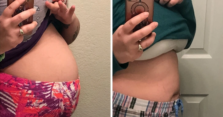 Antes e depois de Patrícia L.